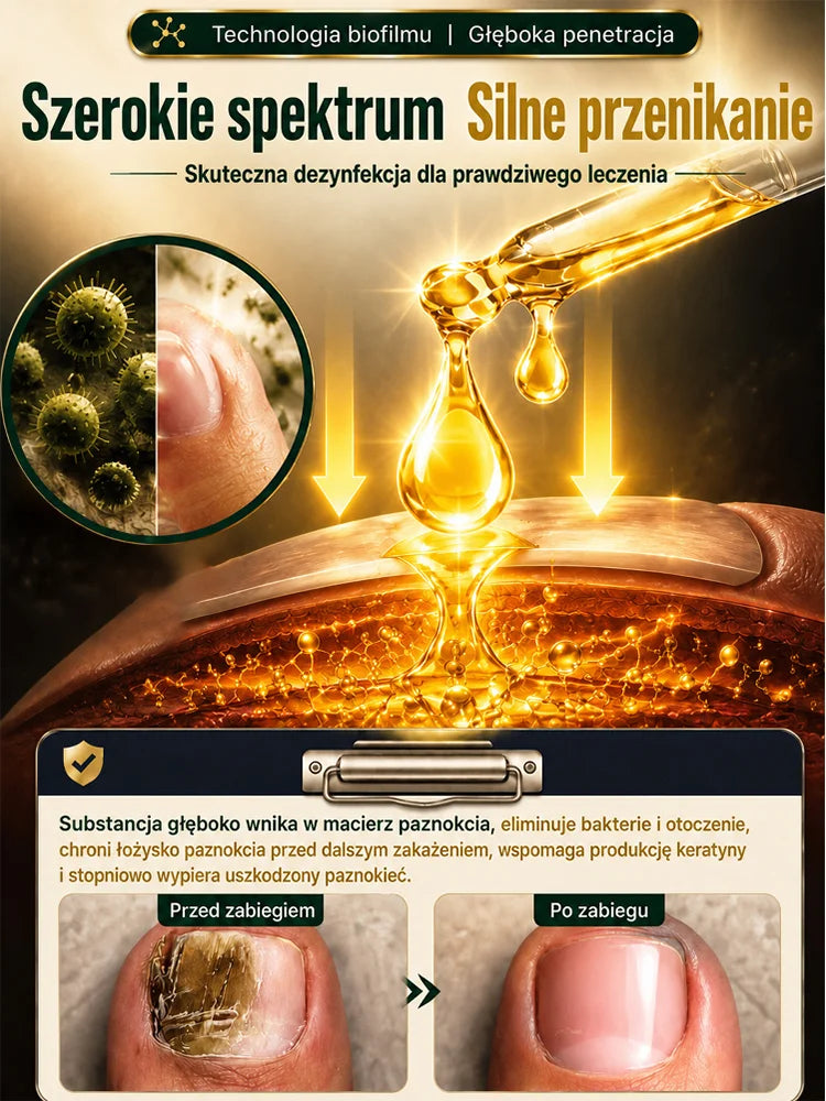 Skuteczny antybakteryjny płyn do paznokci