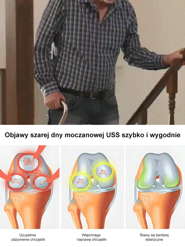 Sadzonka Chelsea Cherry