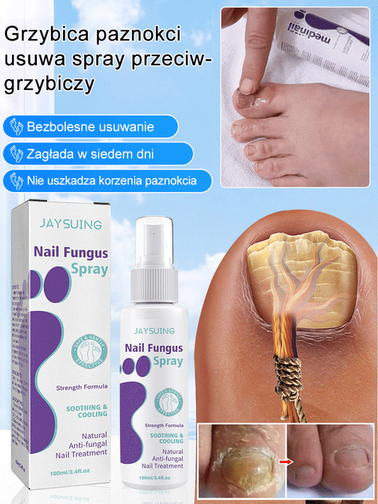 Spray przeciwgrzybiczy do szarych paznokci