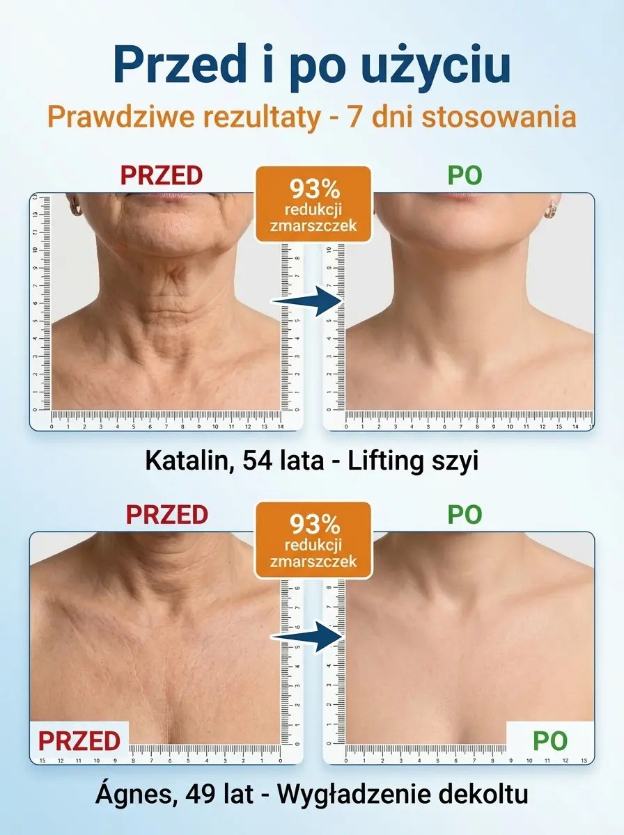 Krem do naprawy zmarszczek na całe ciało "Powrót do 18 lat"