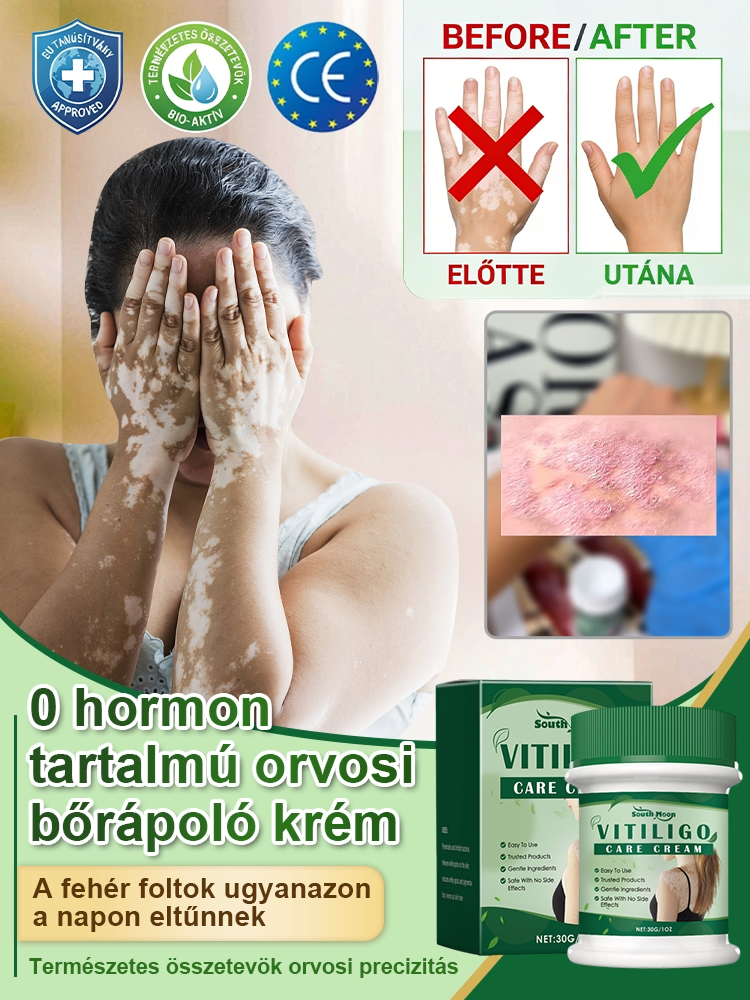 Bezhormonalny krem do pielęgnacji białych plam, szybkie działanie