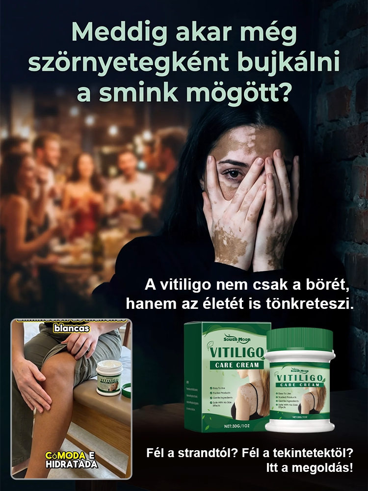 Bezhormonalny krem do pielęgnacji białych plam, szybkie działanie